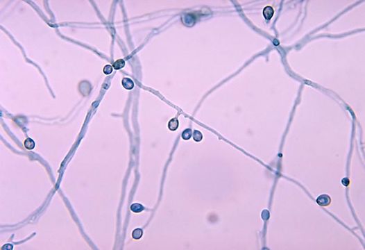 Image of Pseudallescheria boydii (Shear) McGinnis, A. A. Padhye & Ajello 1982