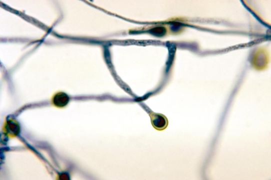 Pseudallescheria boydii (Shear) McGinnis, A. A. Padhye & Ajello 1982 resmi