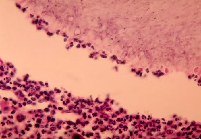 Sivun Pseudallescheria boydii (Shear) McGinnis, A. A. Padhye & Ajello 1982 kuva