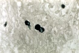Image of Blastomyces dermatitidis Gilchrist & W. R. Stokes 1898