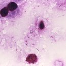 Image of Pneumocystis jirovecii Frenkel 1976