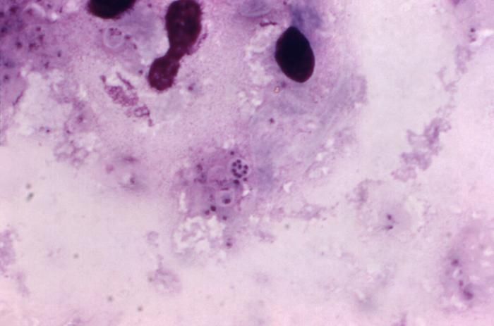 Image of Pneumocystis