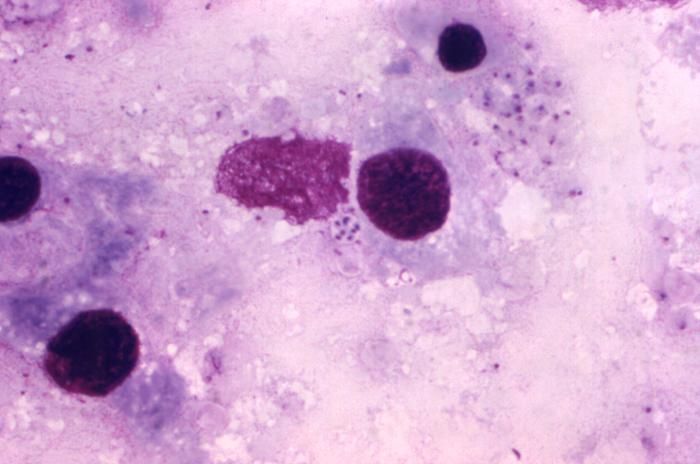 Image of Pneumocystidomycetes