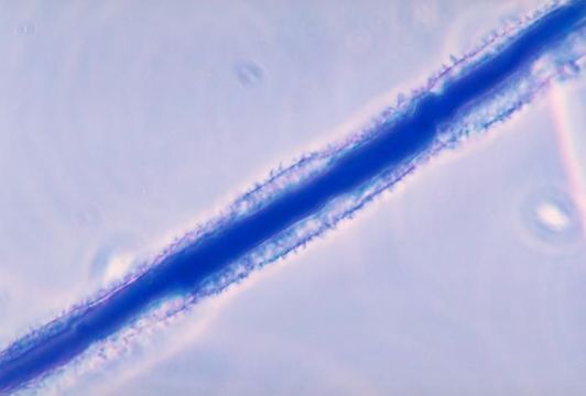 Image of Aspergillus flavus Link 1809