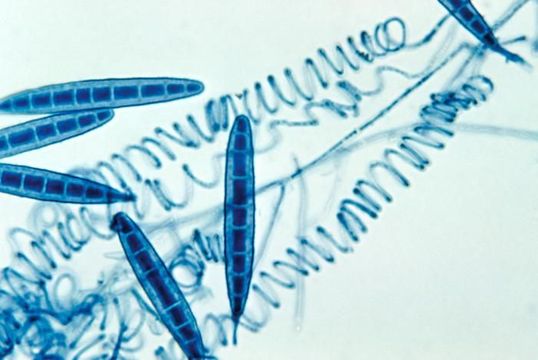 صورة Arthroderma grubyi (Georg, Ajello, Friedman & S. A. Brinkm.) Ajello, Weitzman, McGinnis & A. A. Padhye 1986