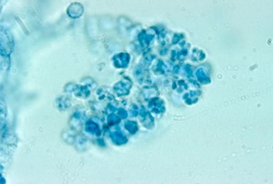 Sivun Arthroderma grubyi (Georg, Ajello, Friedman & S. A. Brinkm.) Ajello, Weitzman, McGinnis & A. A. Padhye 1986 kuva