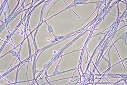 Image de <i>Acremonium recifei</i> (Leão & Lôbo) W. Gams 1971