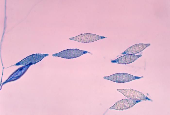Image of <i>Arthroderma otae</i> (A. Haseg. & Usui) McGinnis, Weitzman, A. A. Padhye & Ajello 1986