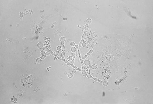 Image de Saccharomycetales incertae sedis