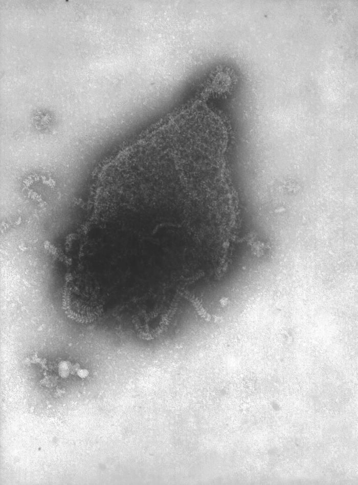 Image of Paramyxovirus