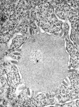 Image of rabies virus and relatives