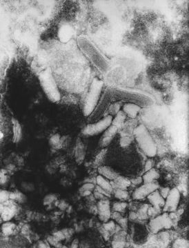 Image of rabies virus and relatives