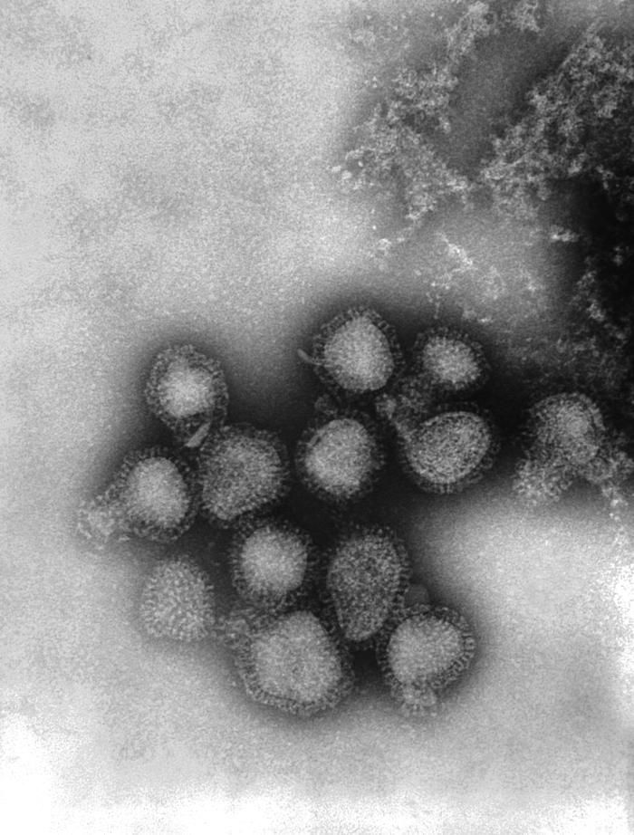 Слика од грипни вируси
