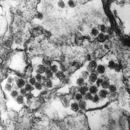 Image of retrovirus
