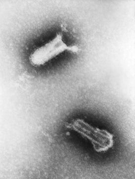 Image of Vesiculovirus