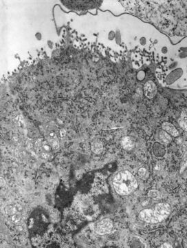 Image of Vesiculovirus