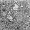 Image of Phlebovirus