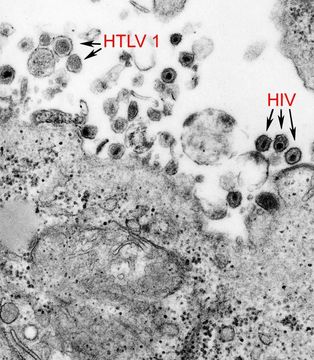 Image of Human T-cell leukemia virus 3 (strain Pyl43)