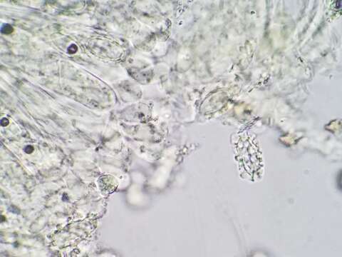 Image of Melastiza cornubiensis (Berk. & Broome) J. Moravec 1992