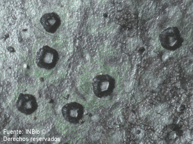 Image of aulaxina lichen