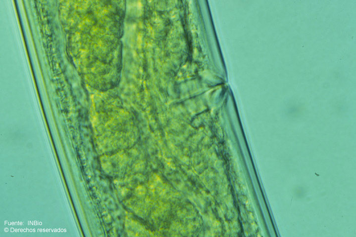 Sivun <i>Pachydorylaimus schizodontus</i> Loof, P. A. A & Zullini & A. 2000 kuva