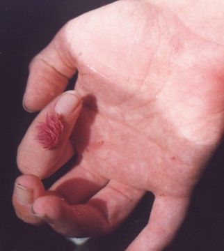 Image of Okenia rosacea (MacFarland 1905)