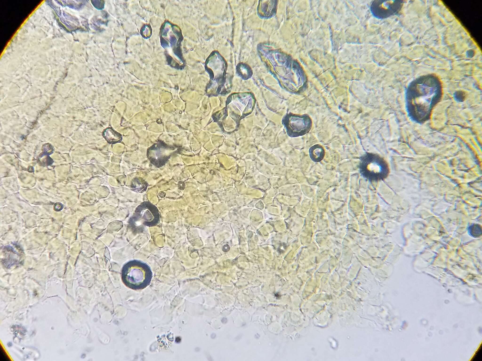 Image of Melastiza cornubiensis (Berk. & Broome) J. Moravec 1992