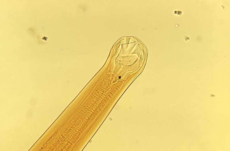Image of Ancylostoma