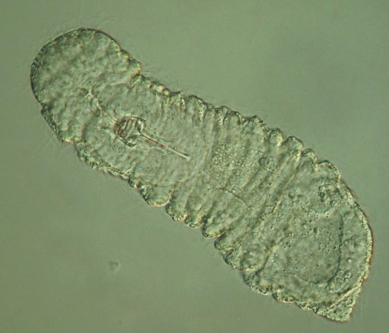 Image de Rastrognathia macrostoma Kristensen & Nørrevang 1977