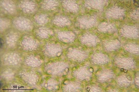 Image of Mesoptychia collaris (Nees) L. Söderstr. & Vána