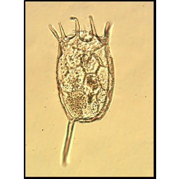 Image of Keratella valga (Ehrenberg 1834)