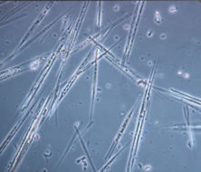 Слика од Rhizosolenianae