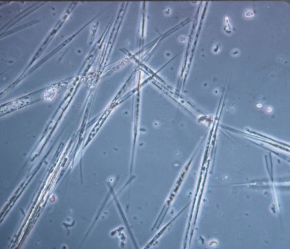 Слика од Rhizosolenianae