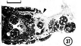 Sivun Carcinonemertes epialti Coe 1902 kuva