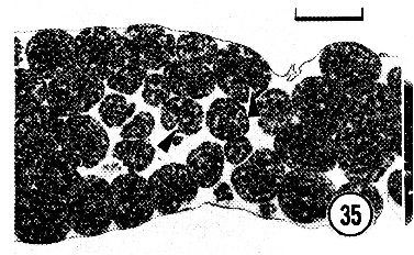 Image of Carcinonemertes epialti Coe 1902
