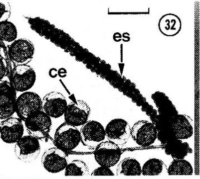 Image of Carcinonemertes epialti Coe 1902