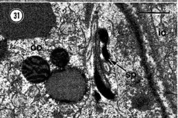 Image of Carcinonemertes epialti Coe 1902