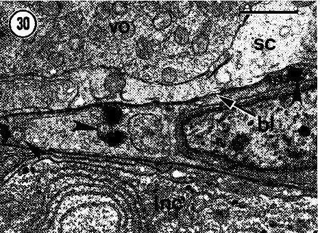 Image of Carcinonemertes epialti Coe 1902