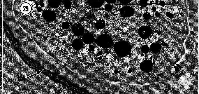 Image of Carcinonemertes epialti Coe 1902