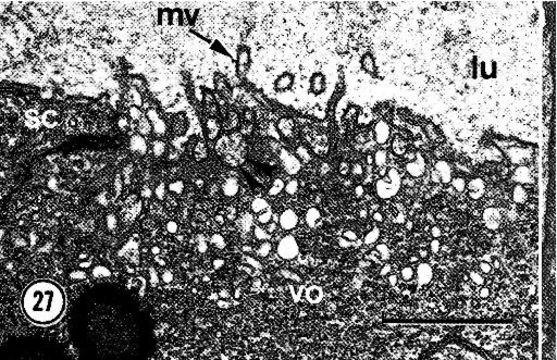 Image of Carcinonemertes epialti Coe 1902