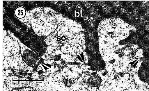 Image of Carcinonemertes epialti Coe 1902