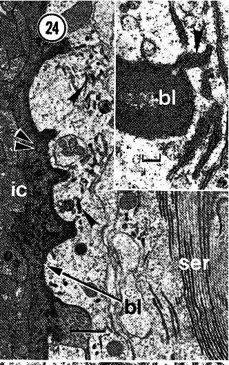 Image of Carcinonemertes epialti Coe 1902