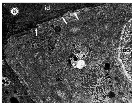 Image of Carcinonemertes epialti Coe 1902