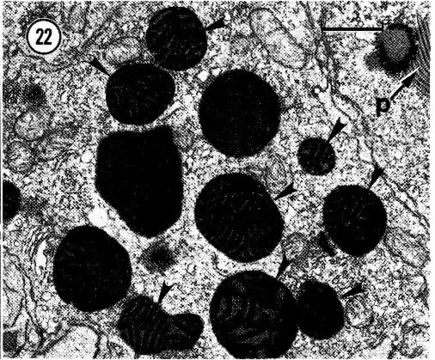 Image of Carcinonemertes epialti Coe 1902