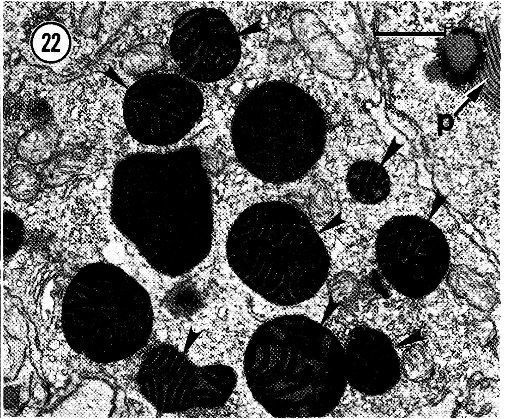 Image of Carcinonemertes epialti Coe 1902