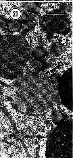 Image of Carcinonemertes epialti Coe 1902