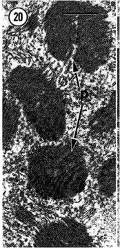 Image of Carcinonemertes epialti Coe 1902