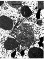 Image of Carcinonemertes epialti Coe 1902