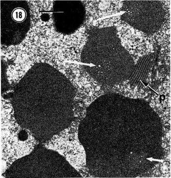 Image of Carcinonemertes epialti Coe 1902