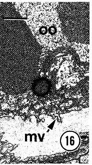 Image of Carcinonemertes epialti Coe 1902